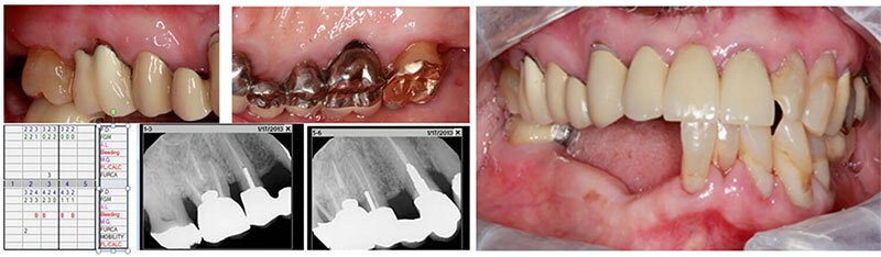 Surgical Dental Treatment Roseville